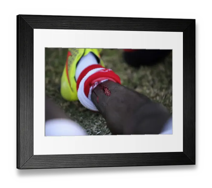 Framed Print : Bristol City Manager Abandons Game After Karleigh Osborne's Injury at Extension Gunners Match (21 / 07 / 2014)