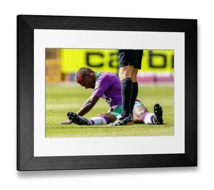 Framed Print : Bloodied Kieran Agard: Notts County vs. Bristol City Football Clash (31 / 04 / 2014) Framed Print : Bloodied Kieran Agard: Notts County vs. Bristol City Football Clash (31 / 04 / 2014)