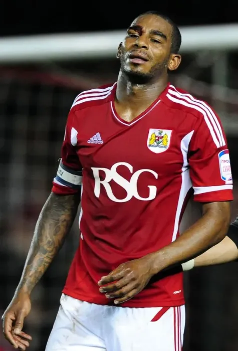 Framed Print : Bristol City's Marvin Elliott Suffers Injury during Championship Match against Reading, September 27, 2011 Framed Print : Bristol City's Marvin Elliott Suffers Injury during Championship Match against Reading, September 27, 2011